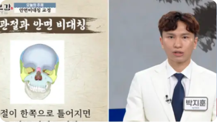 여자보강